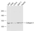 Collagen alpha-1(II) chain Antibody in Western Blot (WB)