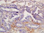 IL-12 beta Antibody in Immunohistochemistry (Paraffin) (IHC (P))