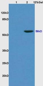 KLF2/4 Antibody in Western Blot (WB)