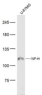 NF-H Antibody in Western Blot (WB)