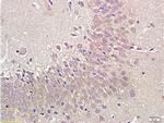 NPY1R Antibody in Immunohistochemistry (Paraffin) (IHC (P))