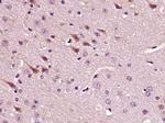 LPCAT2 Antibody in Immunohistochemistry (Paraffin) (IHC (P))