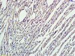 Nrf2 Antibody in Immunohistochemistry (Paraffin) (IHC (P))