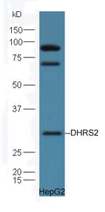 DHRS2 Antibody in Western Blot (WB)