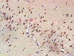 ADORA2B Antibody in Immunohistochemistry (Paraffin) (IHC (P))