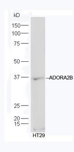 ADORA2B Antibody in Western Blot (WB)