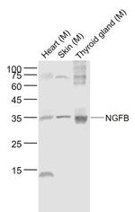 NGFB Antibody in Western Blot (WB)