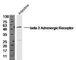 ADRB3 Antibody in Western Blot (WB)