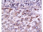 MRP2 Antibody in Immunohistochemistry (Paraffin) (IHC (P))