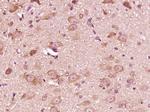 ATP6V1G2 Antibody in Immunohistochemistry (Paraffin) (IHC (P))