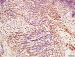 CHI3L1 Antibody in Immunohistochemistry (Paraffin) (IHC (P))