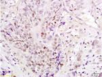 PAX3 Antibody in Immunohistochemistry (Paraffin) (IHC (P))