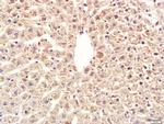 Calpain 1 Antibody in Immunohistochemistry (Paraffin) (IHC (P))