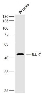 ILDR1 Antibody in Western Blot (WB)