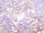 Kinesin Antibody in Immunohistochemistry (Paraffin) (IHC (P))