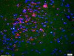 K5A/NKHC1 Antibody in Immunohistochemistry (Paraffin) (IHC (P))