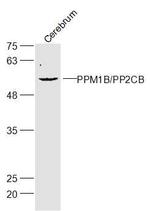 Gliomedin Antibody in Western Blot (WB)