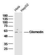 Gliomedin Antibody in Western Blot (WB)