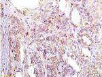 IGFBP2 Antibody in Immunohistochemistry (Paraffin) (IHC (P))