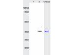 IGFBP2 Antibody in Western Blot (WB)