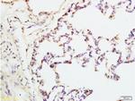 IQGAP1 Antibody in Immunohistochemistry (Paraffin) (IHC (P))