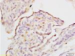 IQGAP1 Antibody in Immunohistochemistry (Paraffin) (IHC (P))