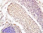 OCT4 Antibody in Immunohistochemistry (Paraffin) (IHC (P))