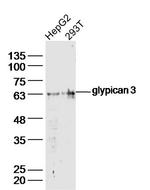 glypican 3 Antibody in Western Blot (WB)