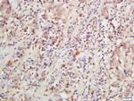 IL-28R Antibody in Immunohistochemistry (Paraffin) (IHC (P))