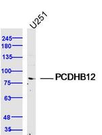 PCDHB12 Antibody in Western Blot (WB)