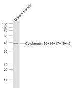 Cytokeratin 10+14+17+19+42 Antibody in Western Blot (WB)