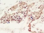 CEBP gamma Antibody in Immunohistochemistry (Paraffin) (IHC (P))