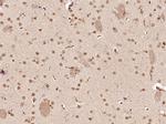 SOX4 Antibody in Immunohistochemistry (Paraffin) (IHC (P))