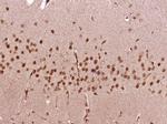 SOX4 Antibody in Immunohistochemistry (Paraffin) (IHC (P))