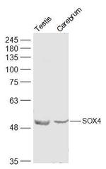 SOX4 Antibody in Western Blot (WB)