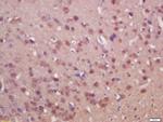 SUFU/Suppressor of Fused Antibody in Immunohistochemistry (Paraffin) (IHC (P))