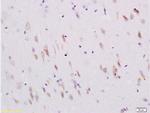 Sema4C Antibody in Immunohistochemistry (Paraffin) (IHC (P))