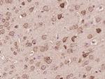 TMP21 Antibody in Immunohistochemistry (Paraffin) (IHC (P))