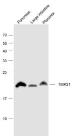 TMP21 Antibody in Western Blot (WB)