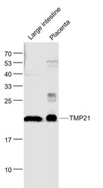 TMP21 Antibody in Western Blot (WB)