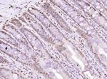 MYO6/Myosin VI Antibody in Immunohistochemistry (Paraffin) (IHC (P))