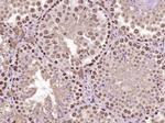 MYO6/Myosin VI Antibody in Immunohistochemistry (Paraffin) (IHC (P))