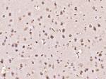 MYO6/Myosin VI Antibody in Immunohistochemistry (Paraffin) (IHC (P))