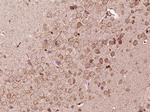 FKBP51 Antibody in Immunohistochemistry (Paraffin) (IHC (P))