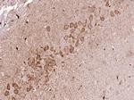 FKBP51 Antibody in Immunohistochemistry (Paraffin) (IHC (P))