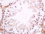 DMO/Dmrt1a Antibody in Immunohistochemistry (Paraffin) (IHC (P))