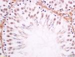 DMO/Dmrt1a Antibody in Immunohistochemistry (Paraffin) (IHC (P))