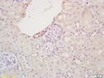 FABP3 Antibody in Immunohistochemistry (Paraffin) (IHC (P))