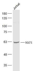 SGLT1 Antibody in Western Blot (WB)