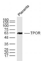 TPOR Antibody in Western Blot (WB)